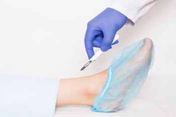 foot surgery
